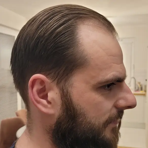 Media: 646f4088168ef665241134.jpg