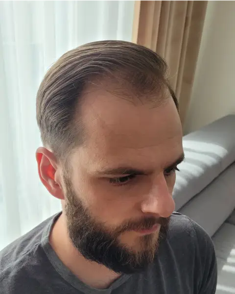 Media: 64e8e49ad9bd8812592519.jpg